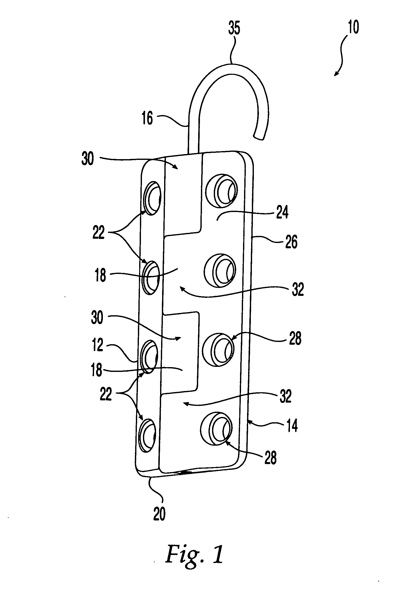 Sternum fixation device