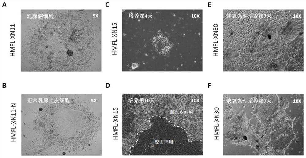 Primary mammary epithelial cell culture medium, culture method and application