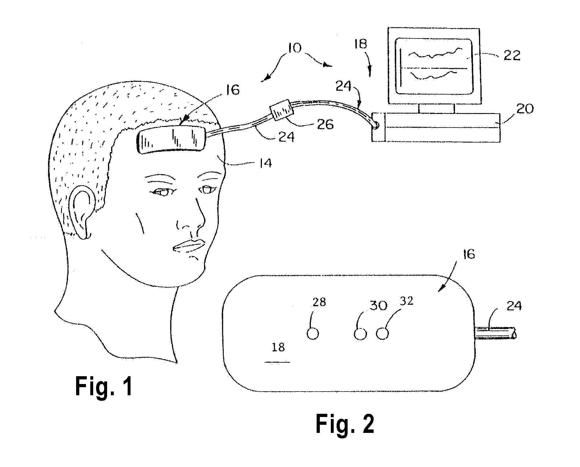 System and method of resolving outliers in NIRS cerebral oximetry