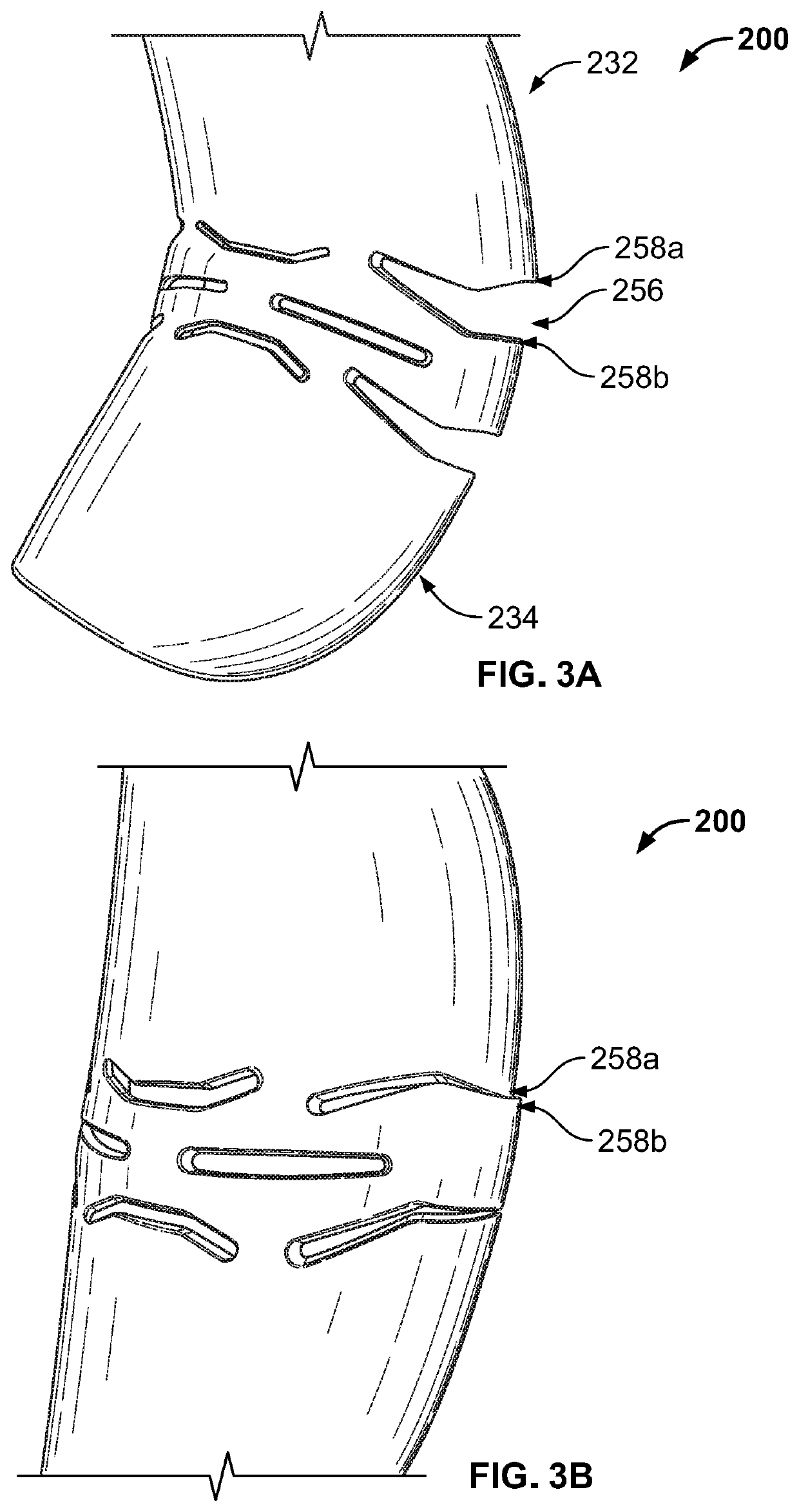 Flexible Metatarsal Guard