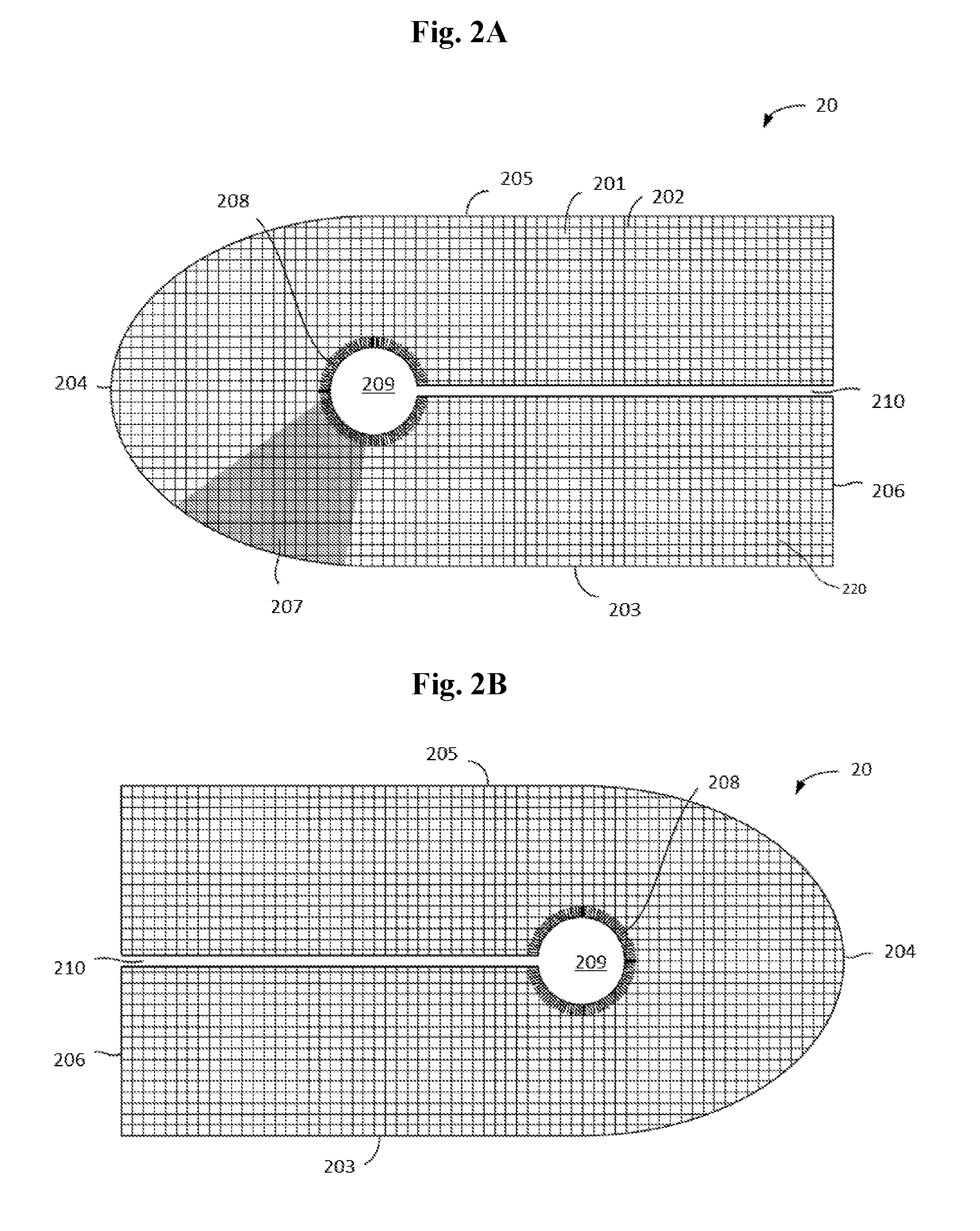 Gender-specific mesh implant with barrier for inguinal hernia repair