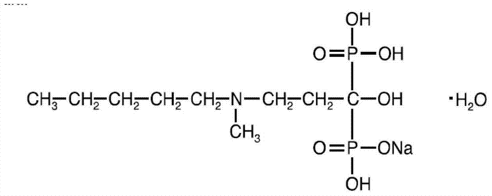 Sodium ibandronate injection composition and preparation method of sodium ibandronate injection composition