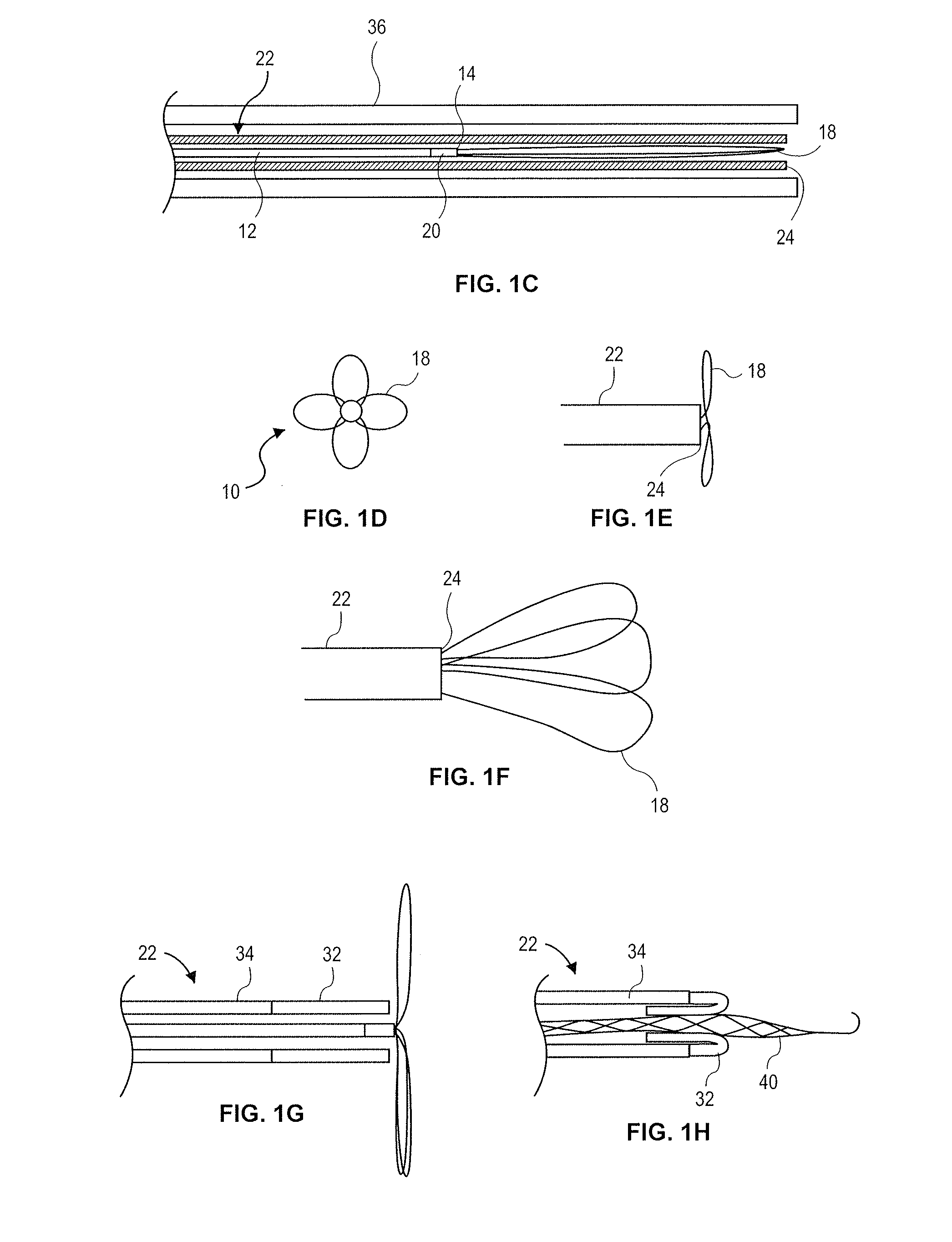 Retrieval snare device and method