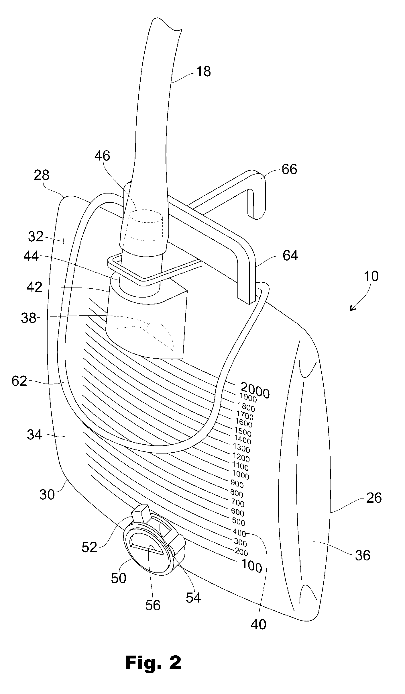 Urinary Drainage Bag for Urinary Diversion to the Bellie Button