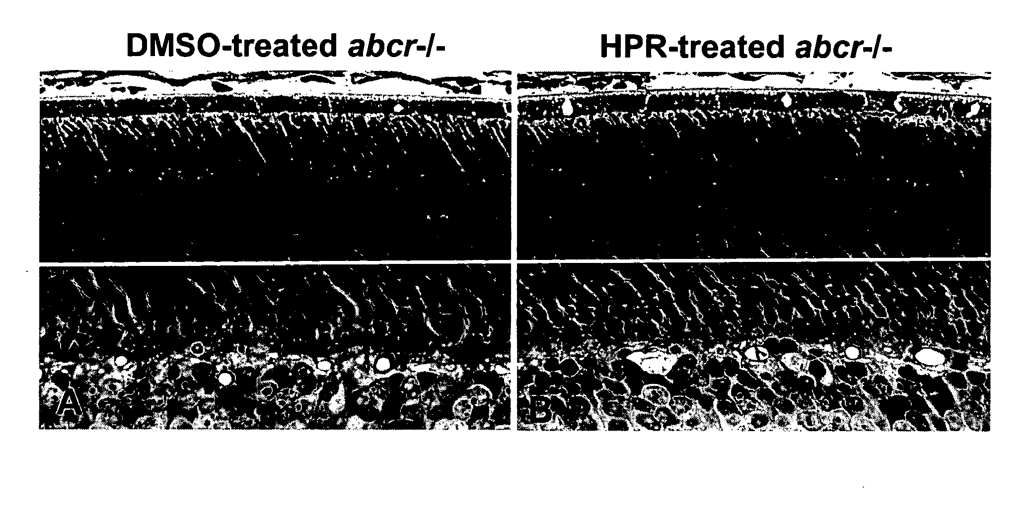 Methods and compositions for treating ophthalmic conditions with retinyl derivatives