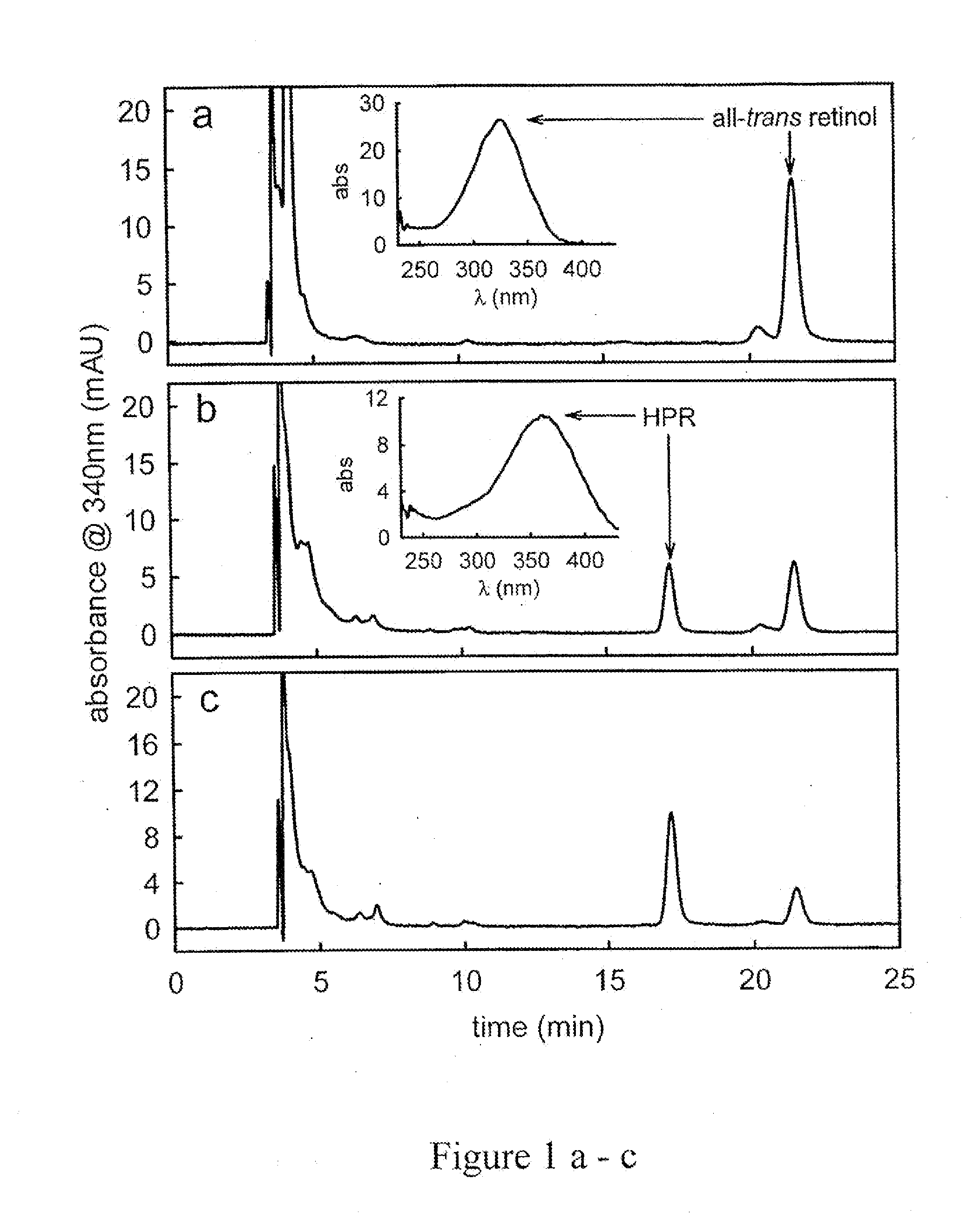 Methods and compositions for treating ophthalmic conditions with retinyl derivatives