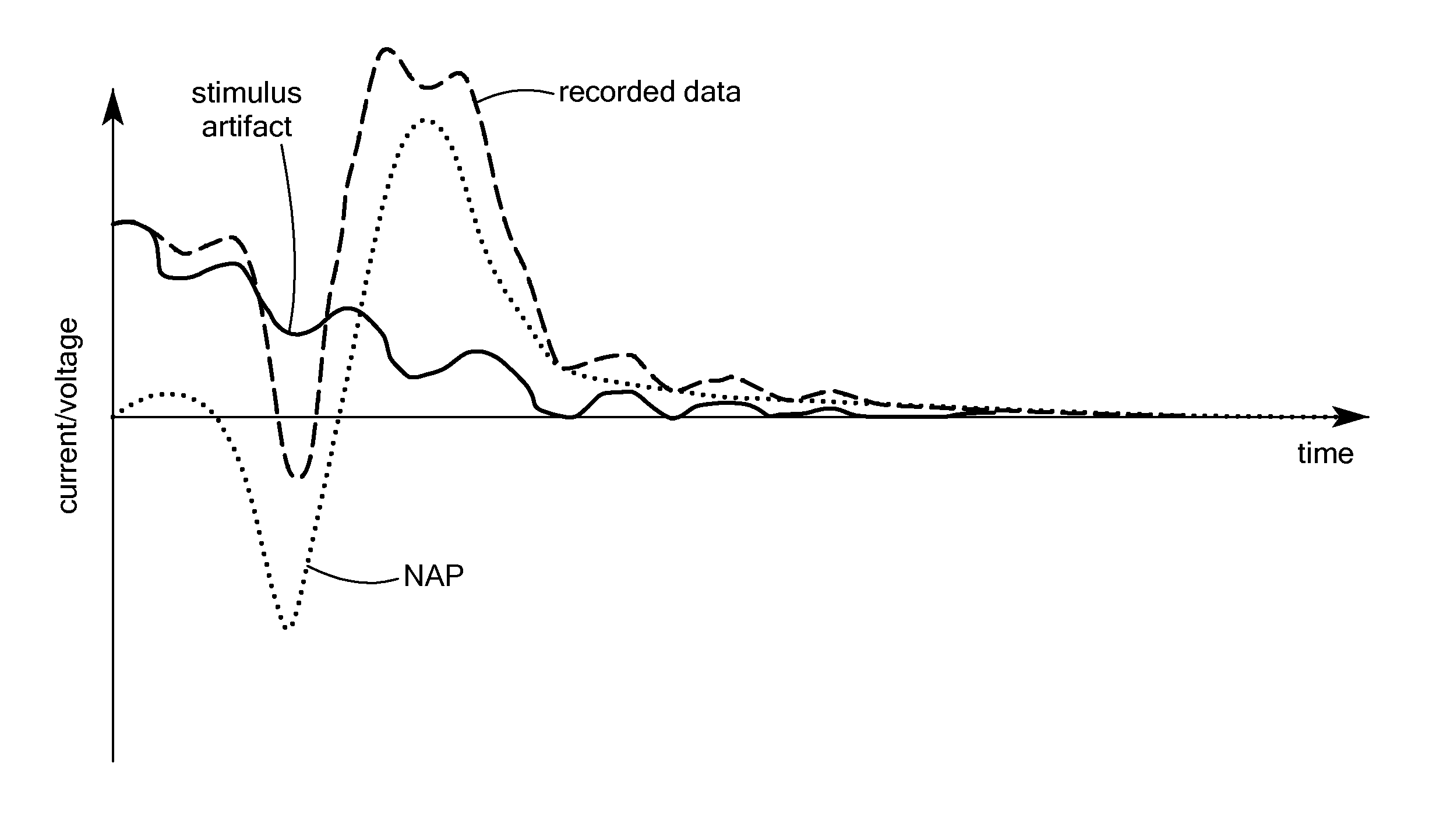 Stimulus artifact removal for neuronal recordings