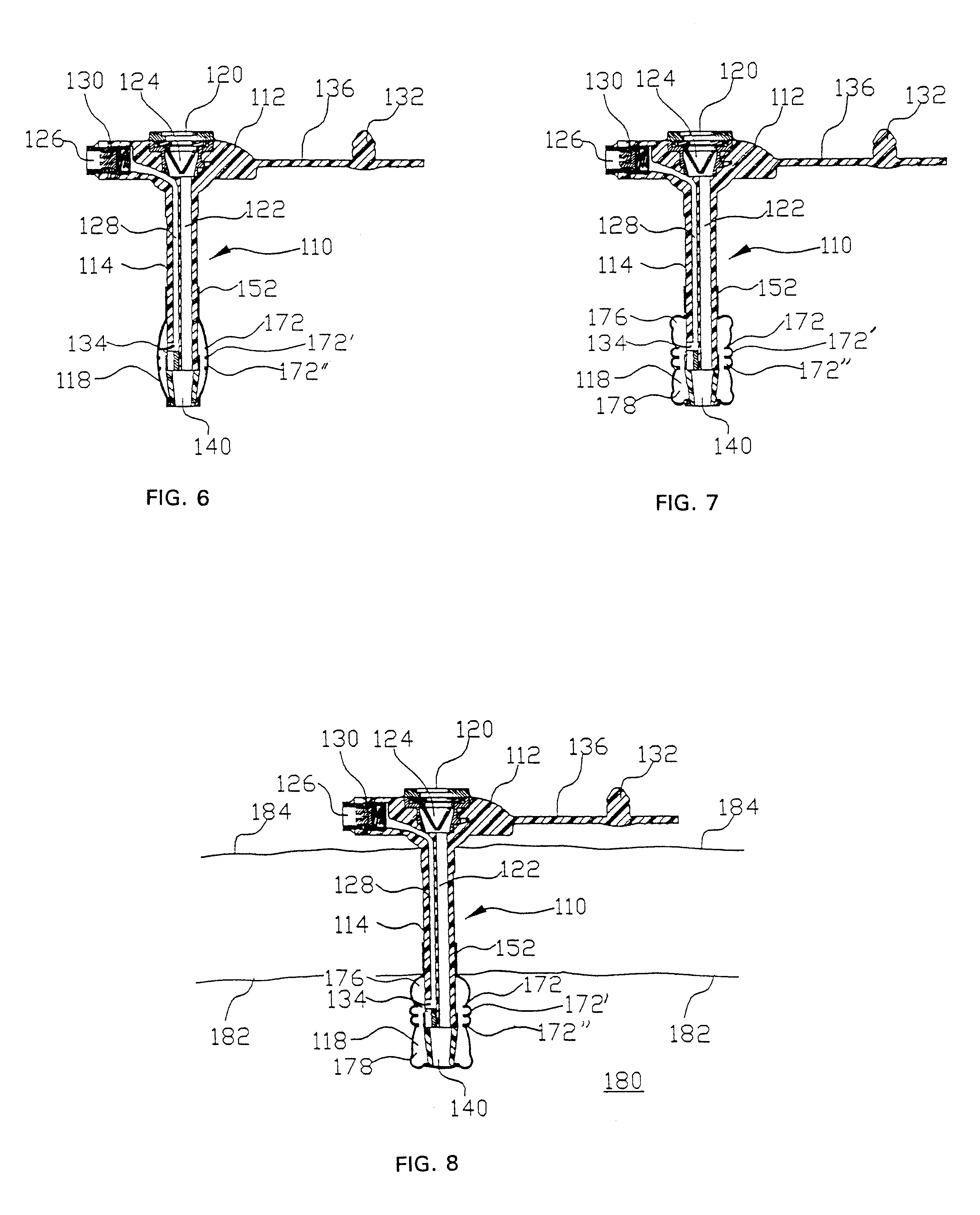 Catheter with distally distending balloon