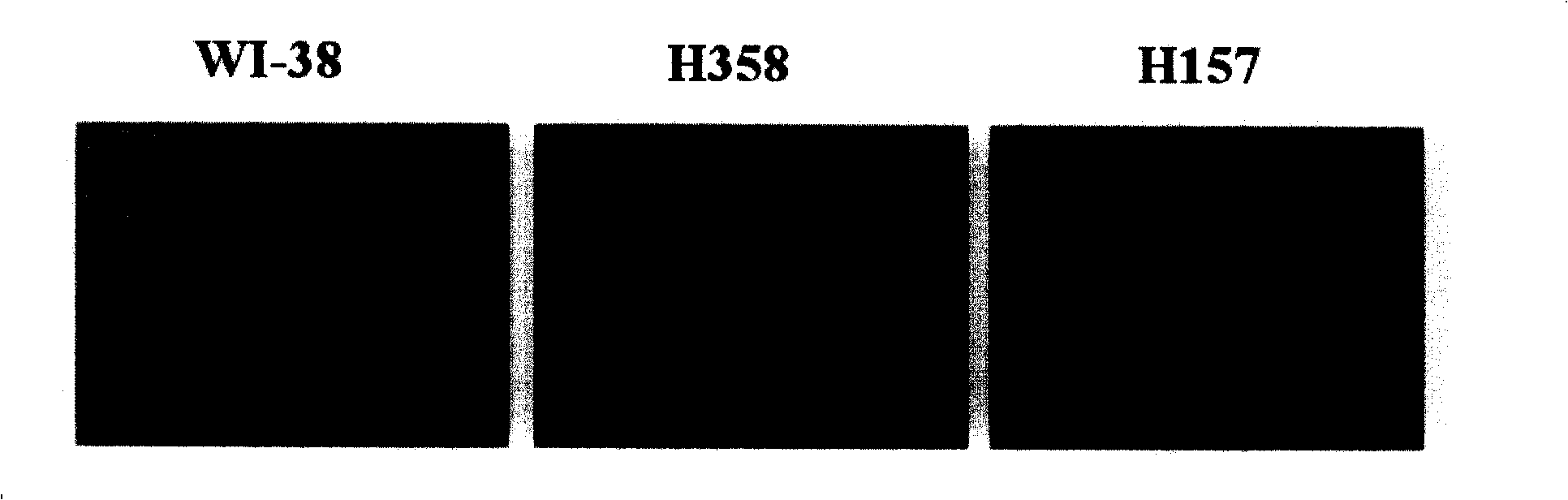 Novel use of ubiquitin c-terminal hydrolase-l1