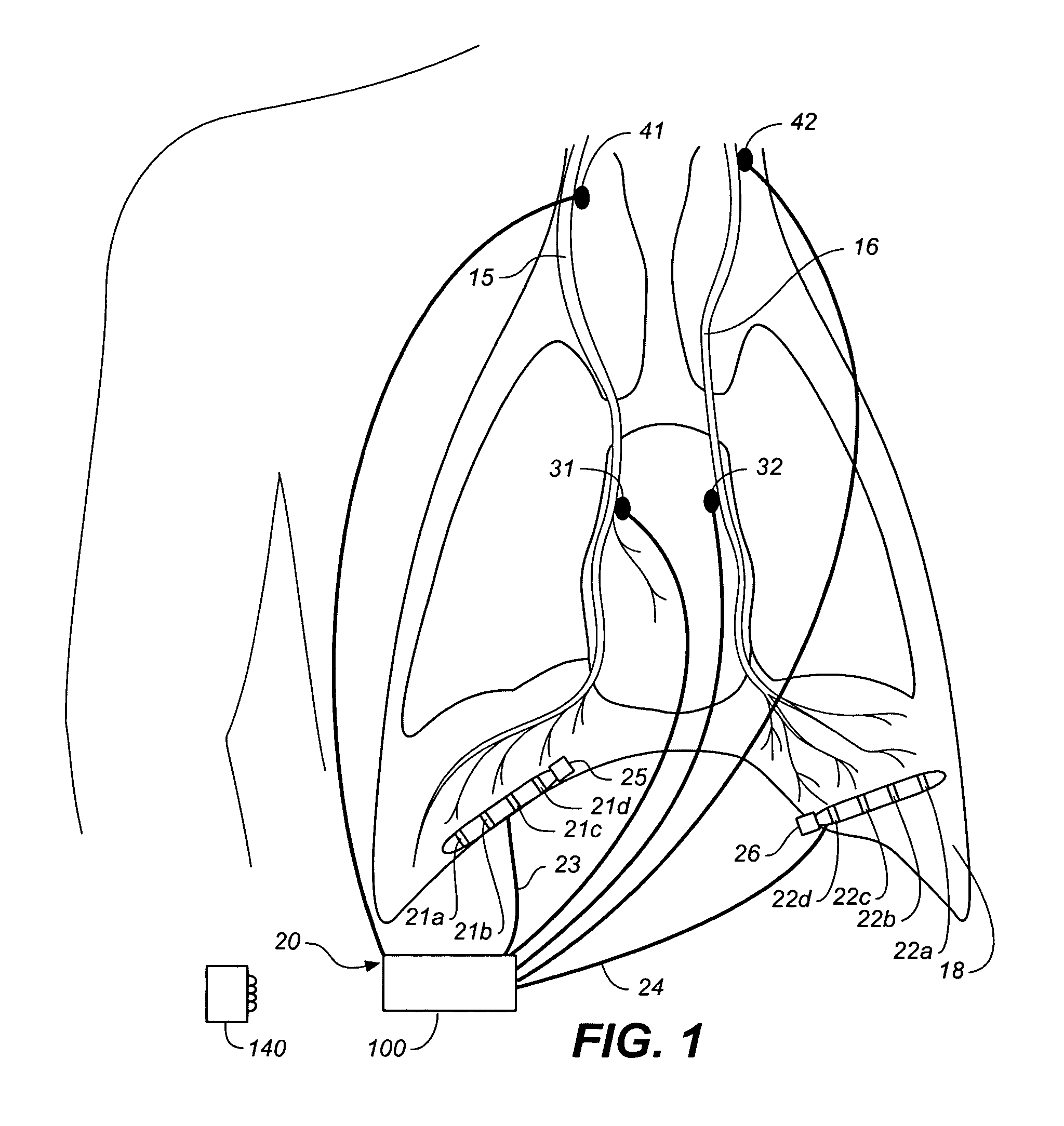 Device and method for gradually controlling breathing