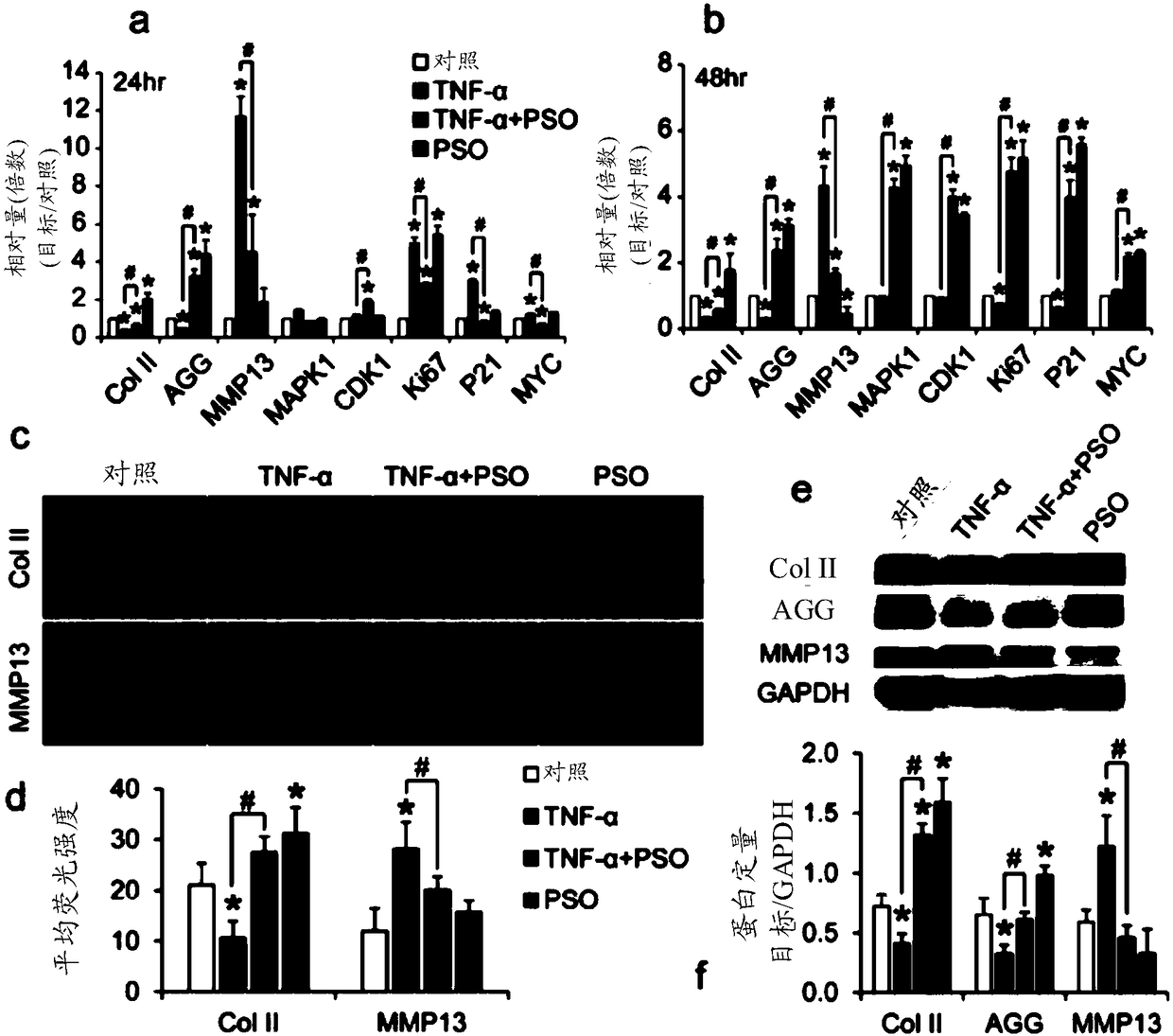 Application of psoralen to preparation of medicinal composition and medicinal composition