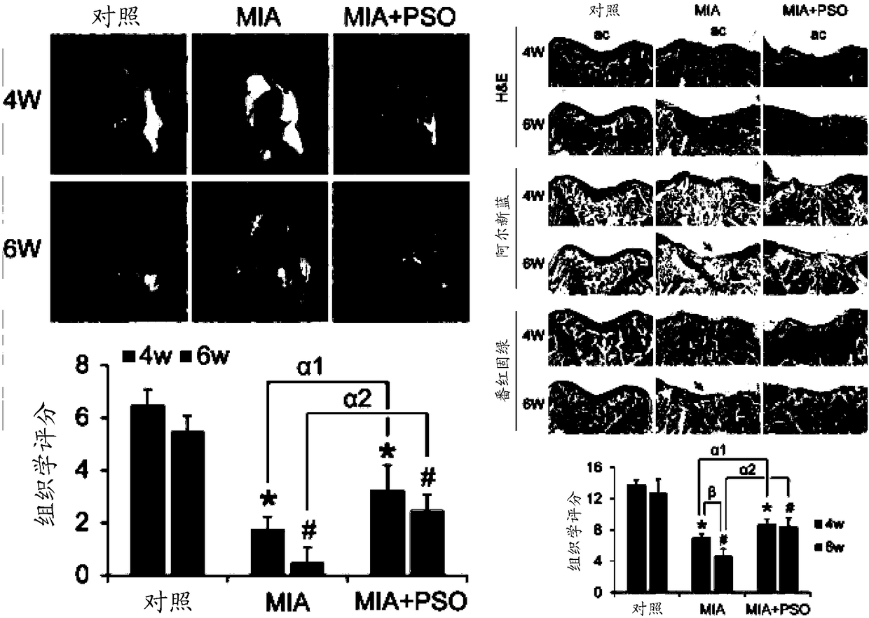 Application of psoralen to preparation of medicinal composition and medicinal composition