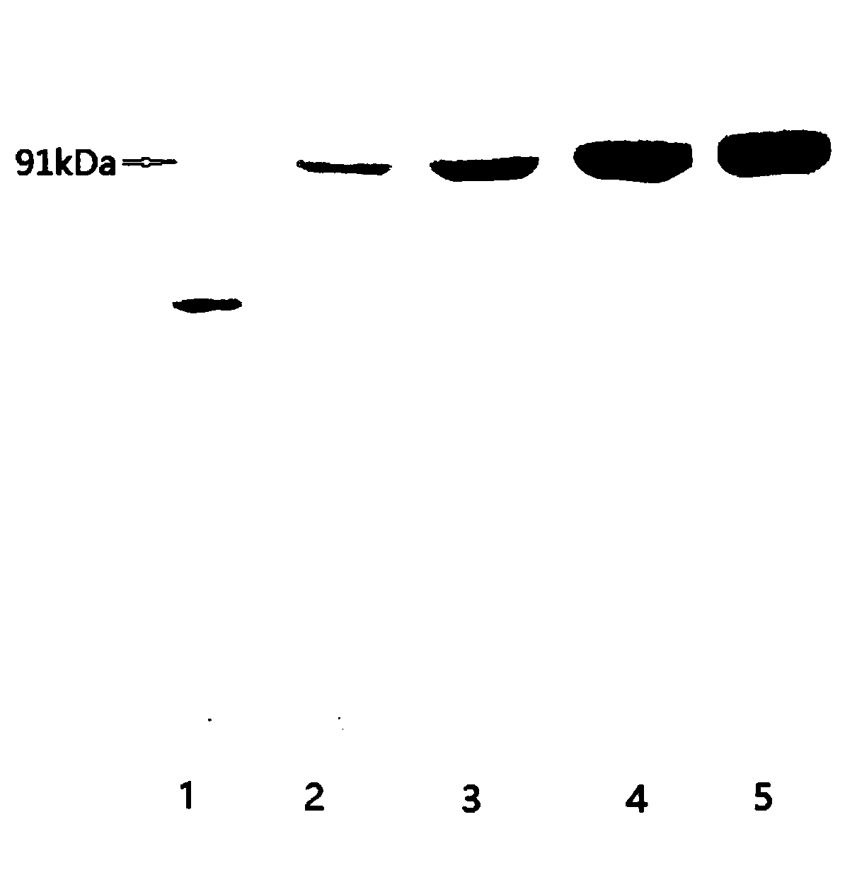 Method for extracting crystals of urease in canavalia ensiformis