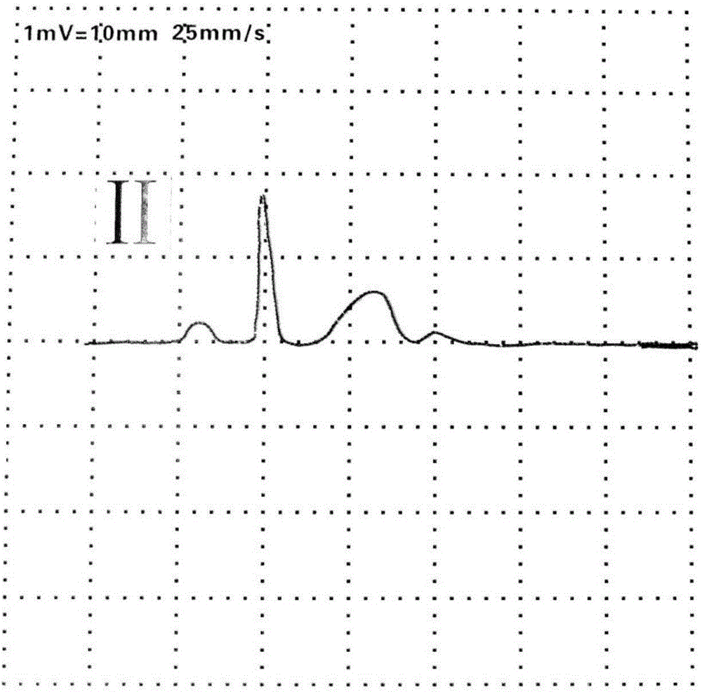 Electrocardiogram and vector cardiogram experiment operating panel