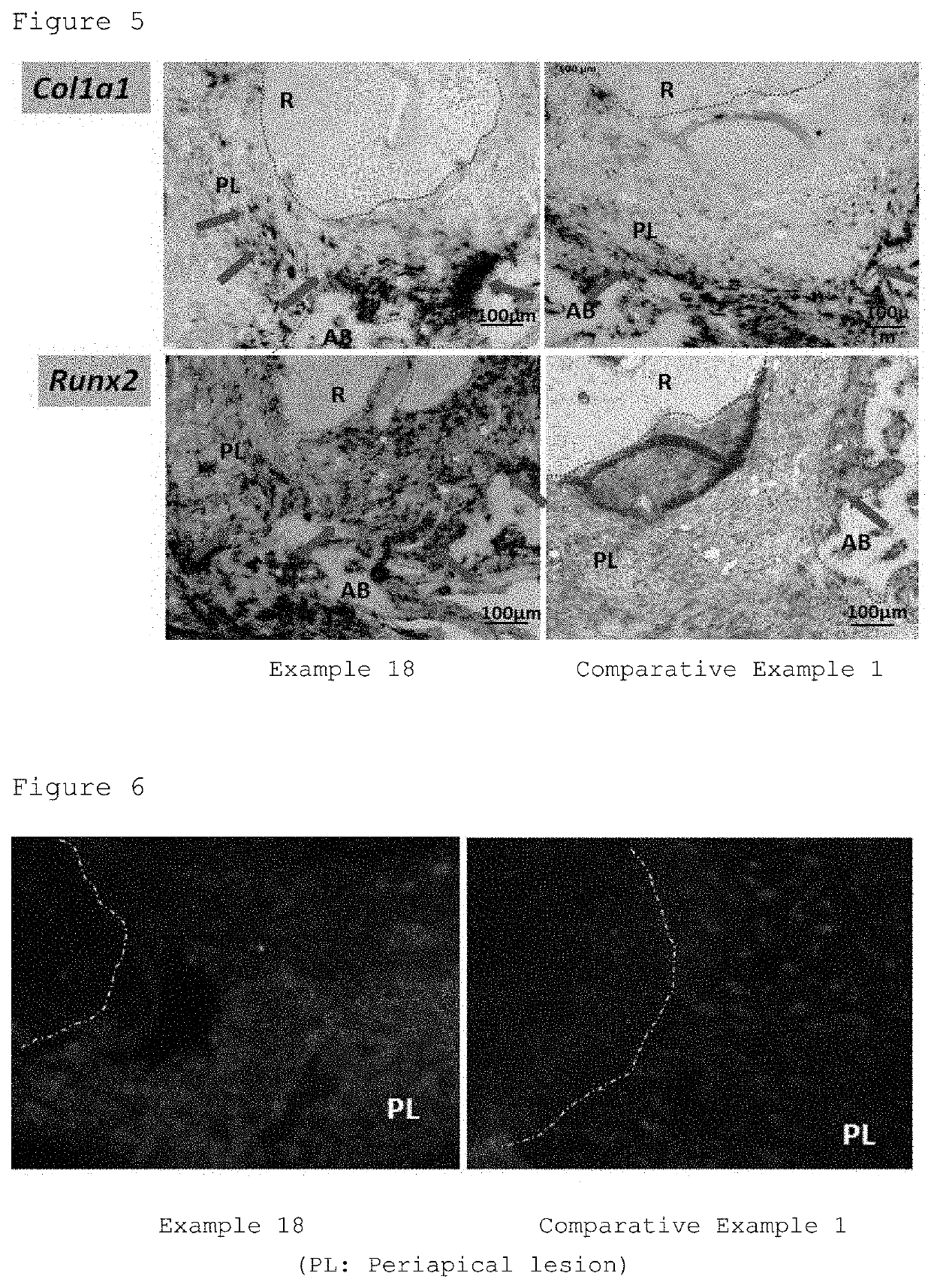 Dental root canal filling material composition