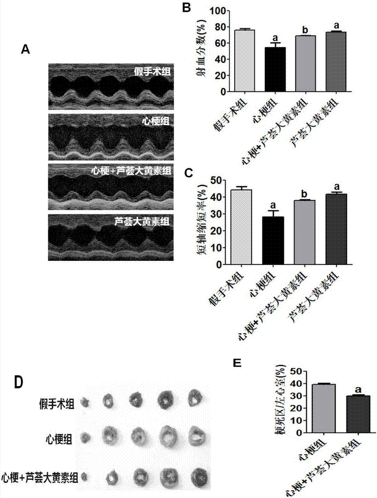 Use of aloeemodin in preparing of medicament for preventing and treating myocardial ischemia and arrhythmia