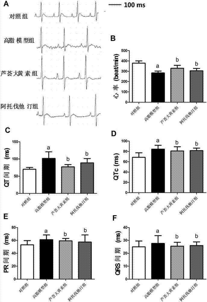 Use of aloeemodin in preparing of medicament for preventing and treating myocardial ischemia and arrhythmia