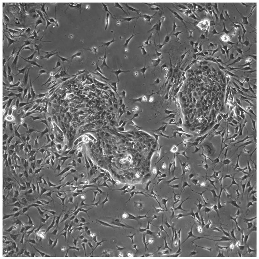 Construction method of immortalized forest musk gland epithelial cells