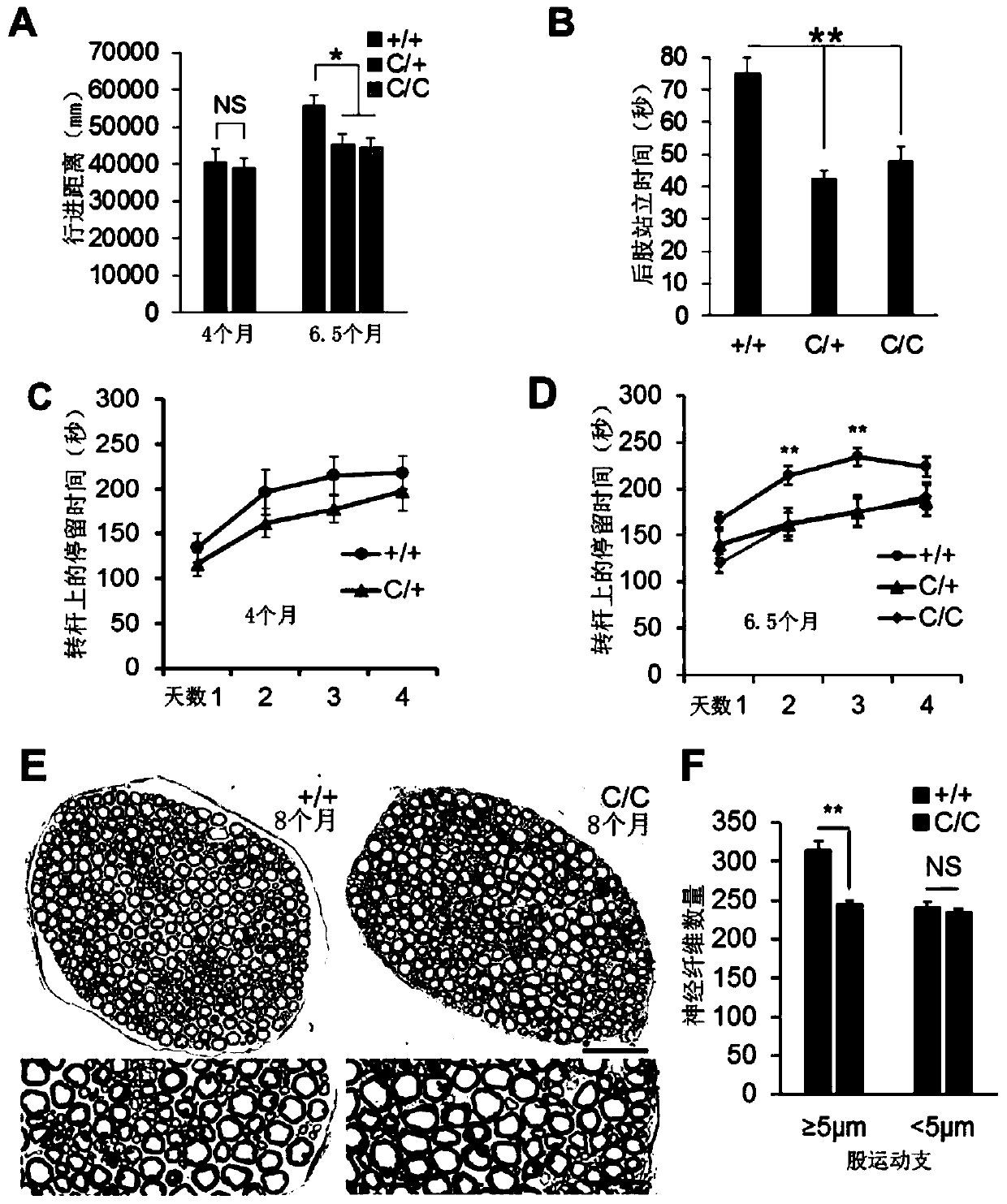 Trim72 as potential therapeutic target for als through ubiquitinating mutant fus protein