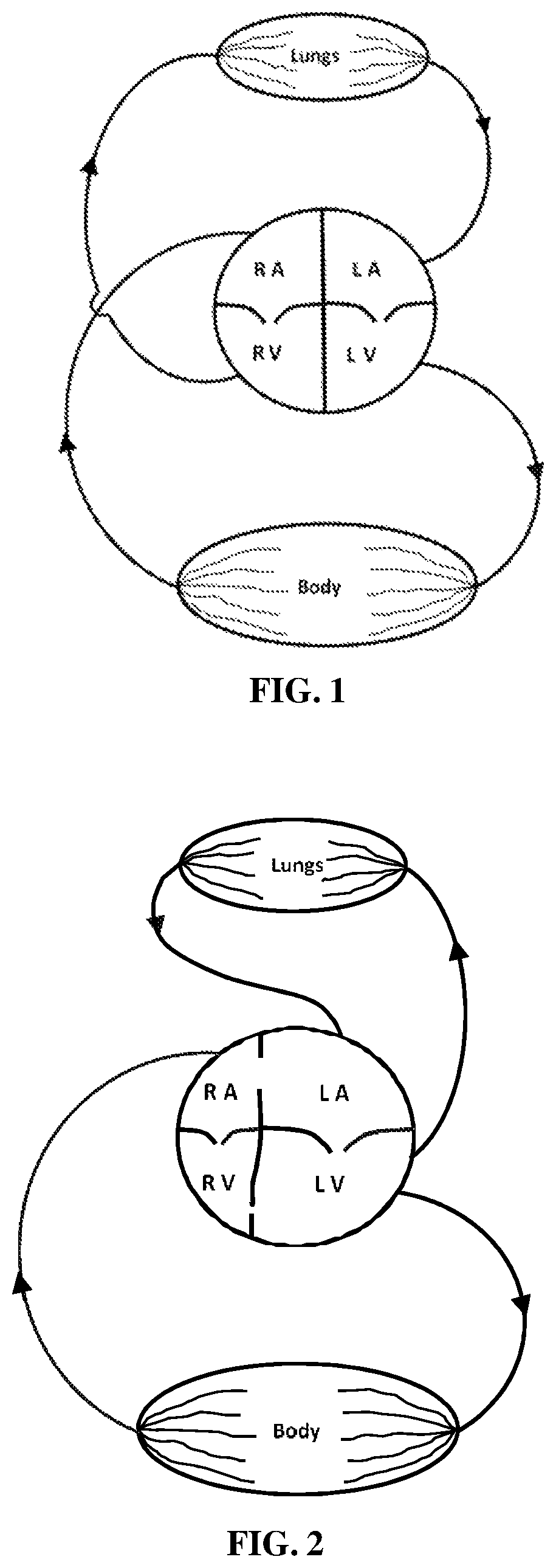 Implantable cardio-vascular flow streamliner