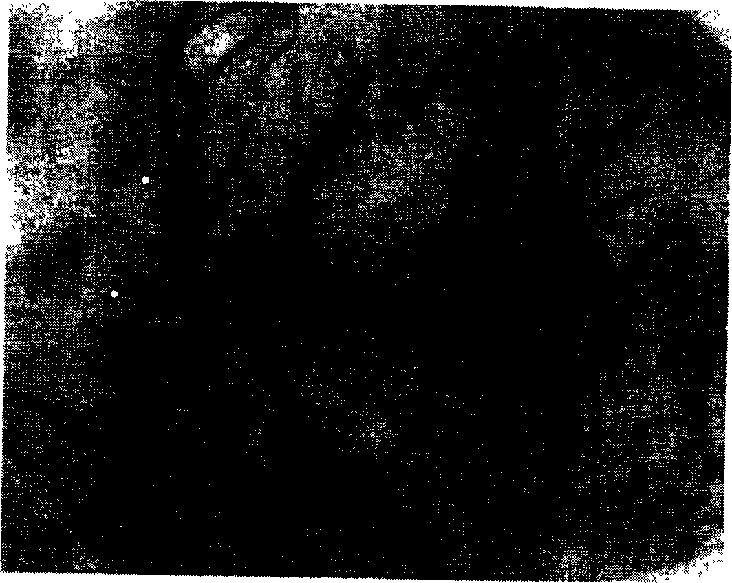 Method and equipment for transcranial cerebral blood flow high-resolution imaging