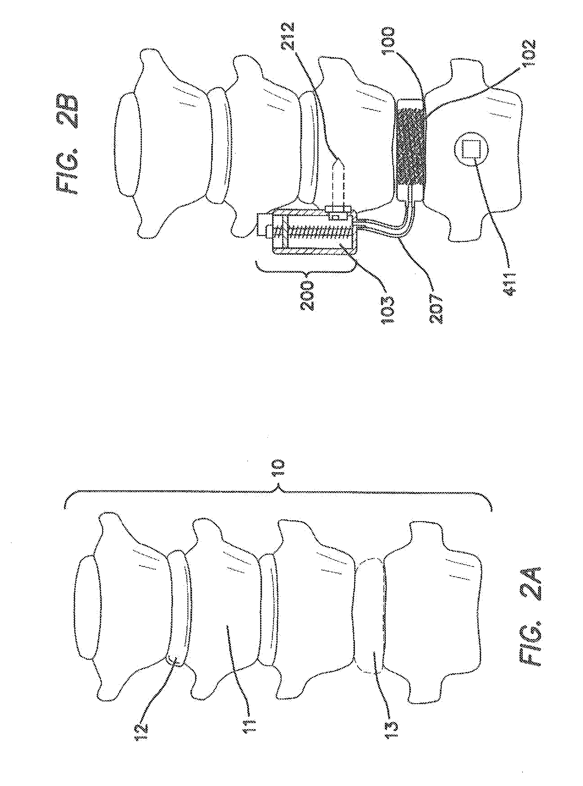 Remotely Activated Piezoelectric Pump for Delivery of Biological Agents to the Intervertebral Disc and Spine