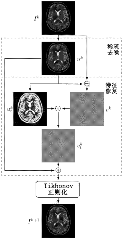 Magnetic resonance fast imaging method and system based on iterative feature correction