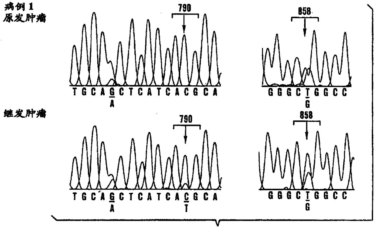 Method for treating gefitinib resistant cancer