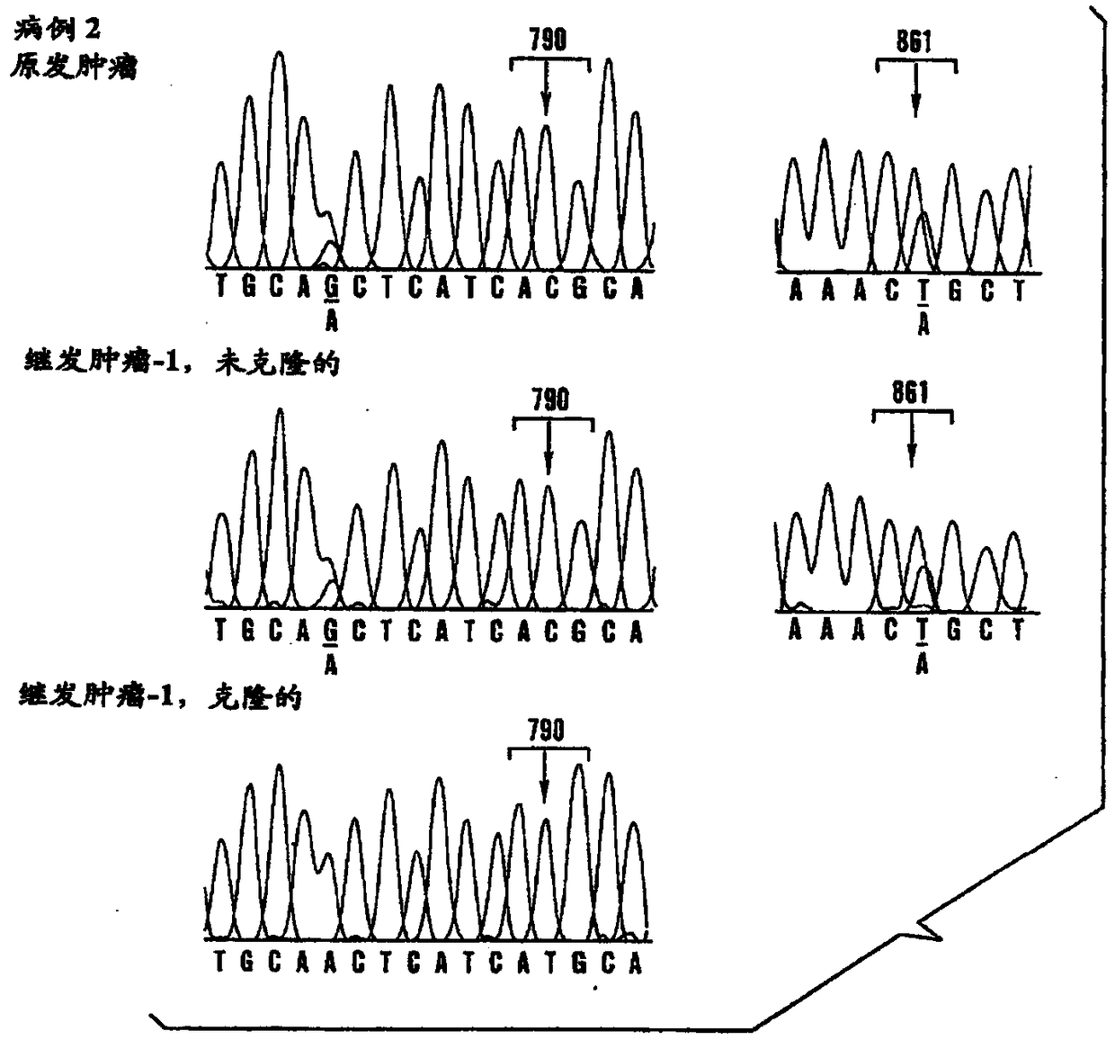 Method for treating gefitinib resistant cancer