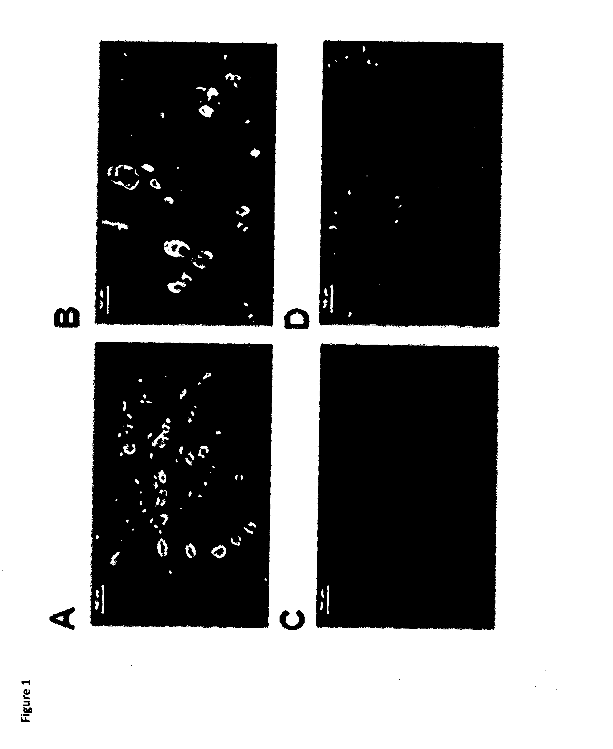 Methods of Treating Pain by Inhibition of VGF Activity