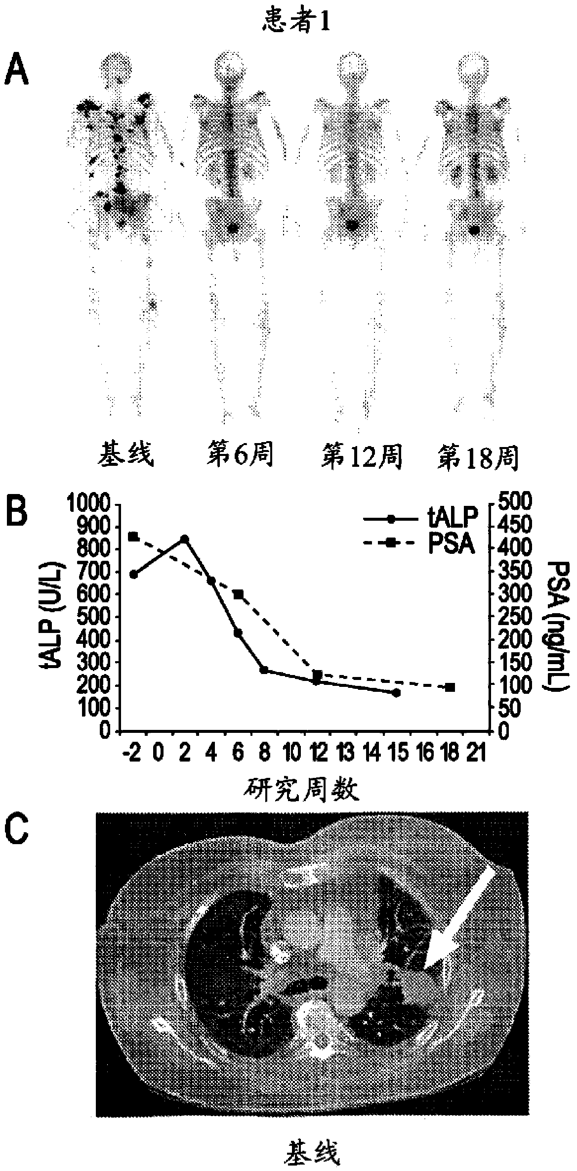 Dual inhibitors of met and vegf for the treatment of castration resistant prostate cancer and osteoblastic bone metastases