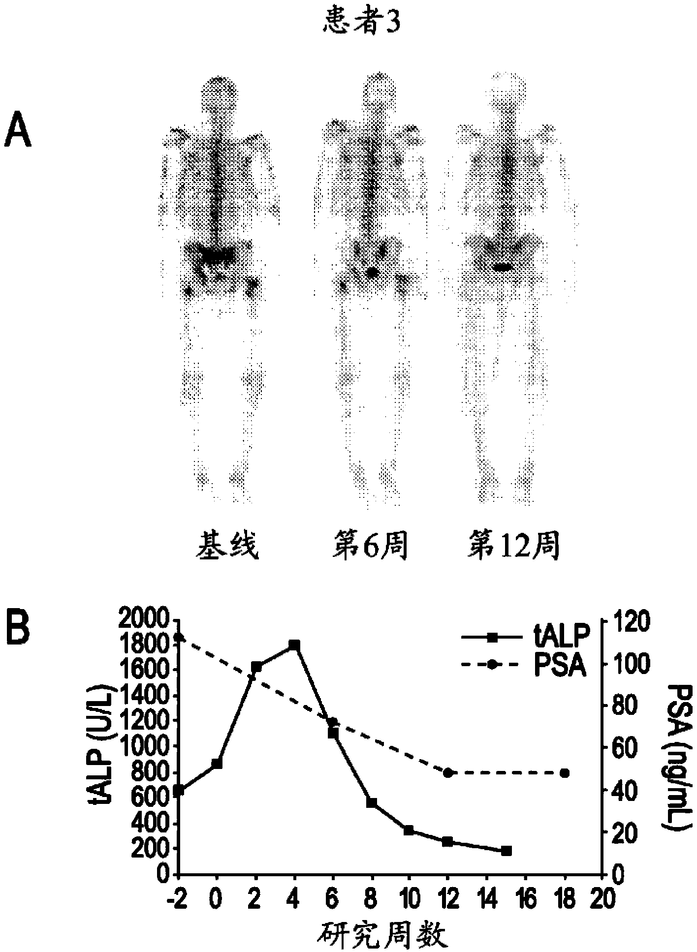 Dual inhibitors of met and vegf for the treatment of castration resistant prostate cancer and osteoblastic bone metastases