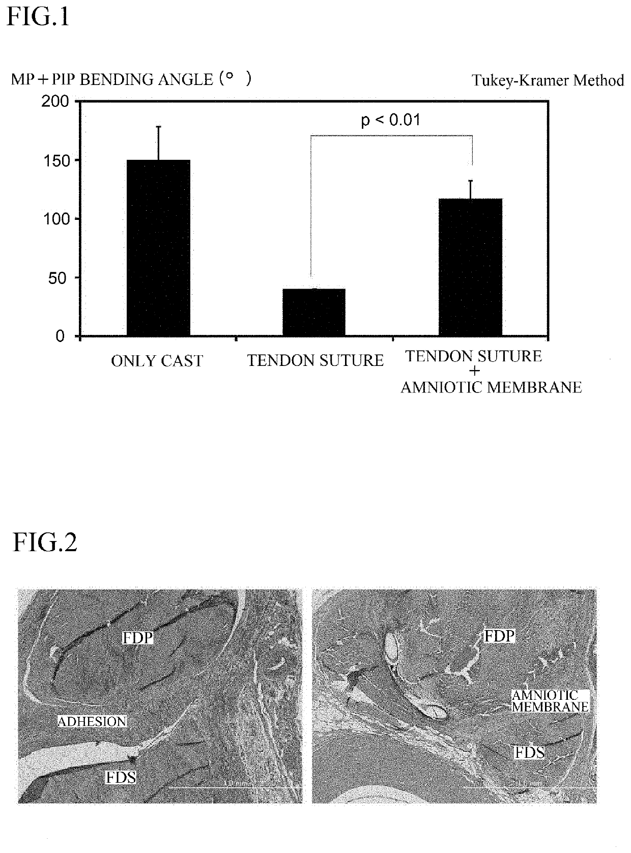 Regeneration of tendon and tendon sheath, restoration material, and use of restoration material