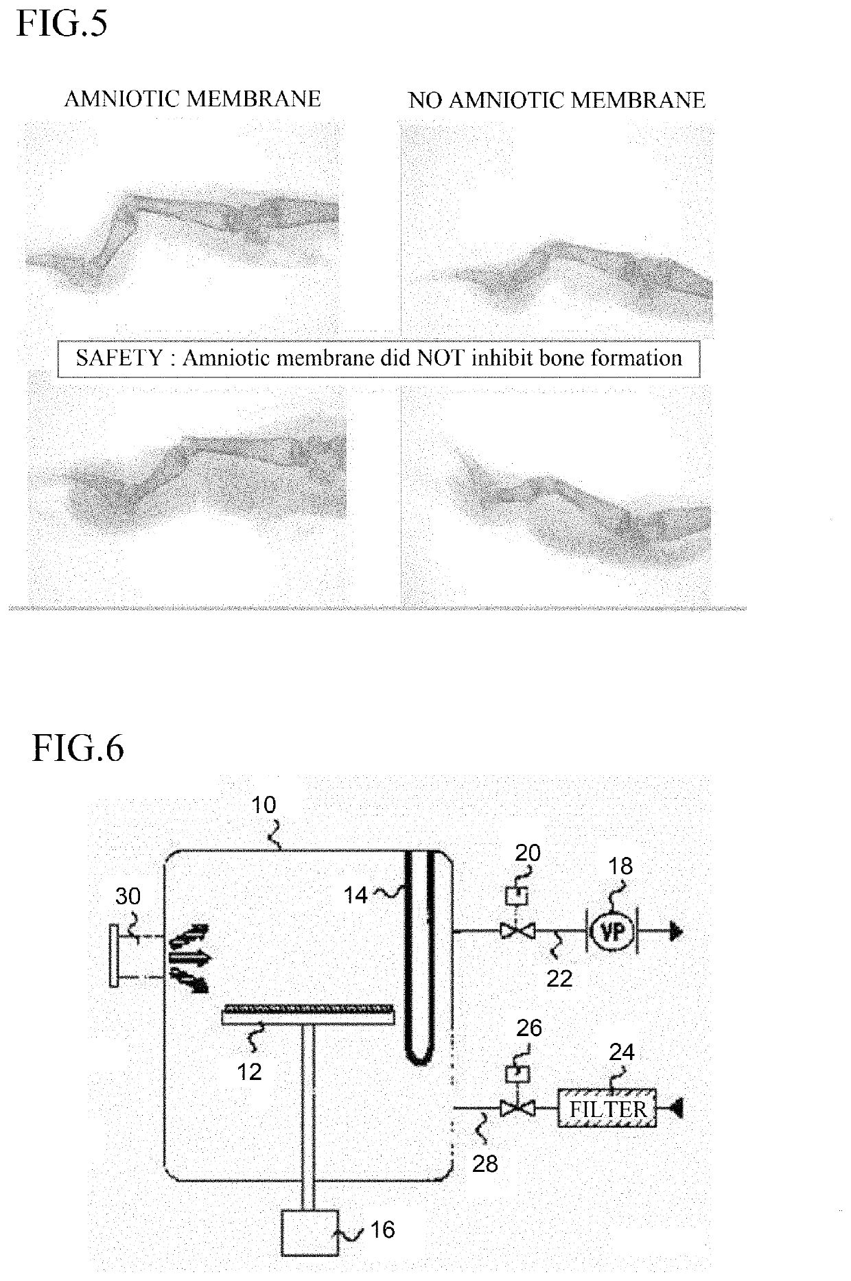 Regeneration of tendon and tendon sheath, restoration material, and use of restoration material