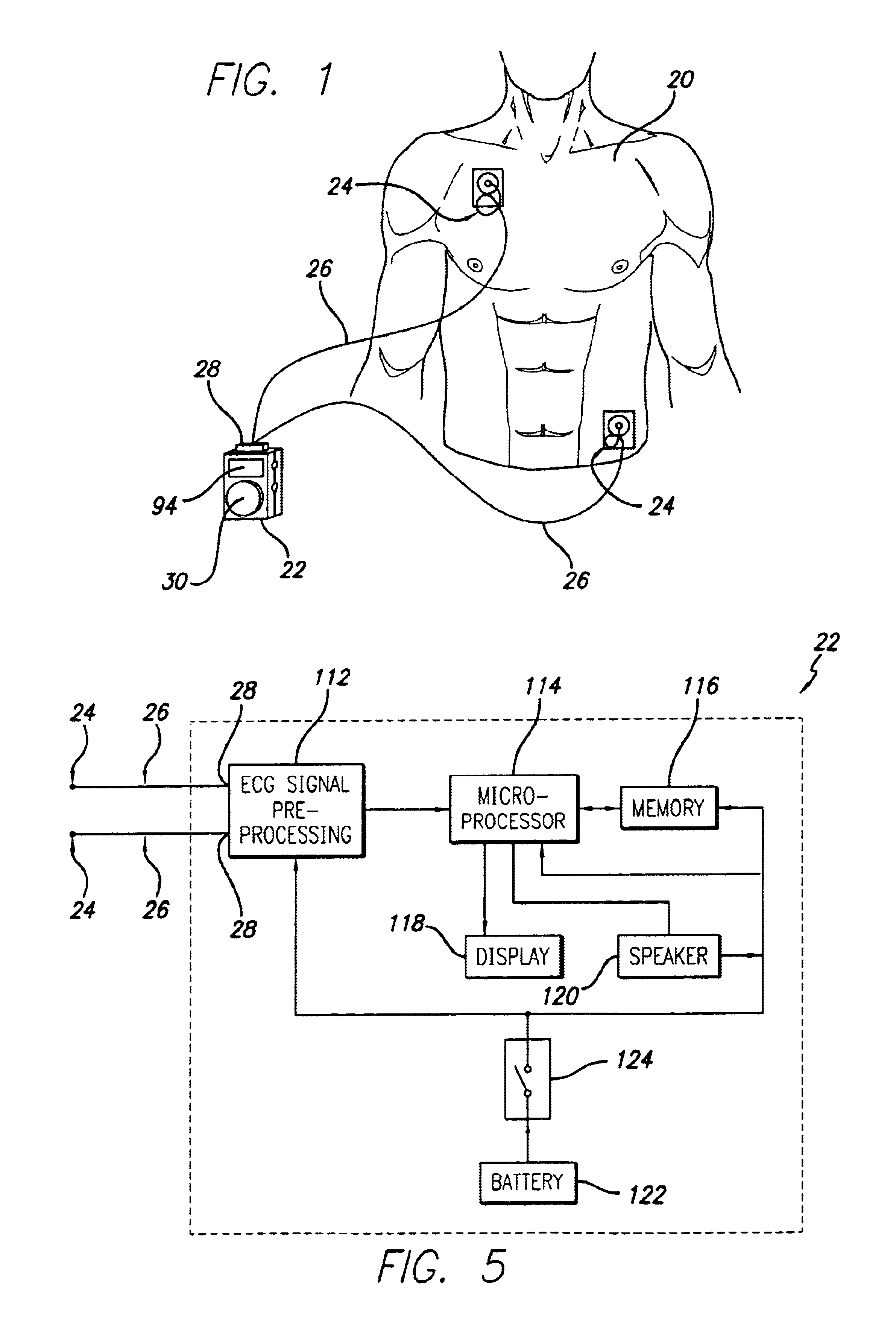 Portable ECG monitor and method for atrial fibrillation detection