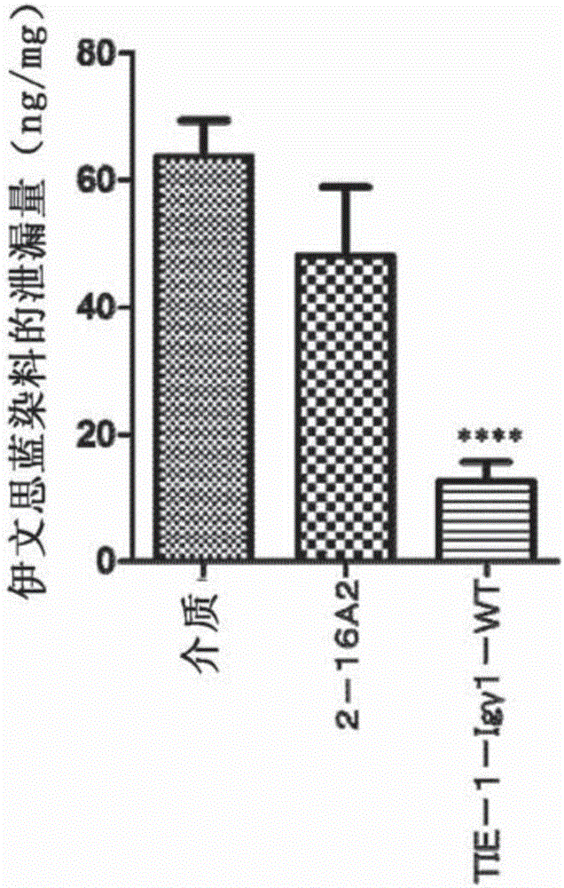 Novel anti-human Tie2 antibody