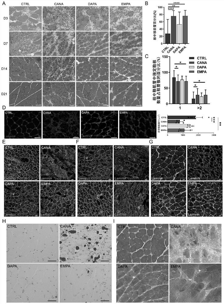 Application of leucyl-tRNA synthetase 2