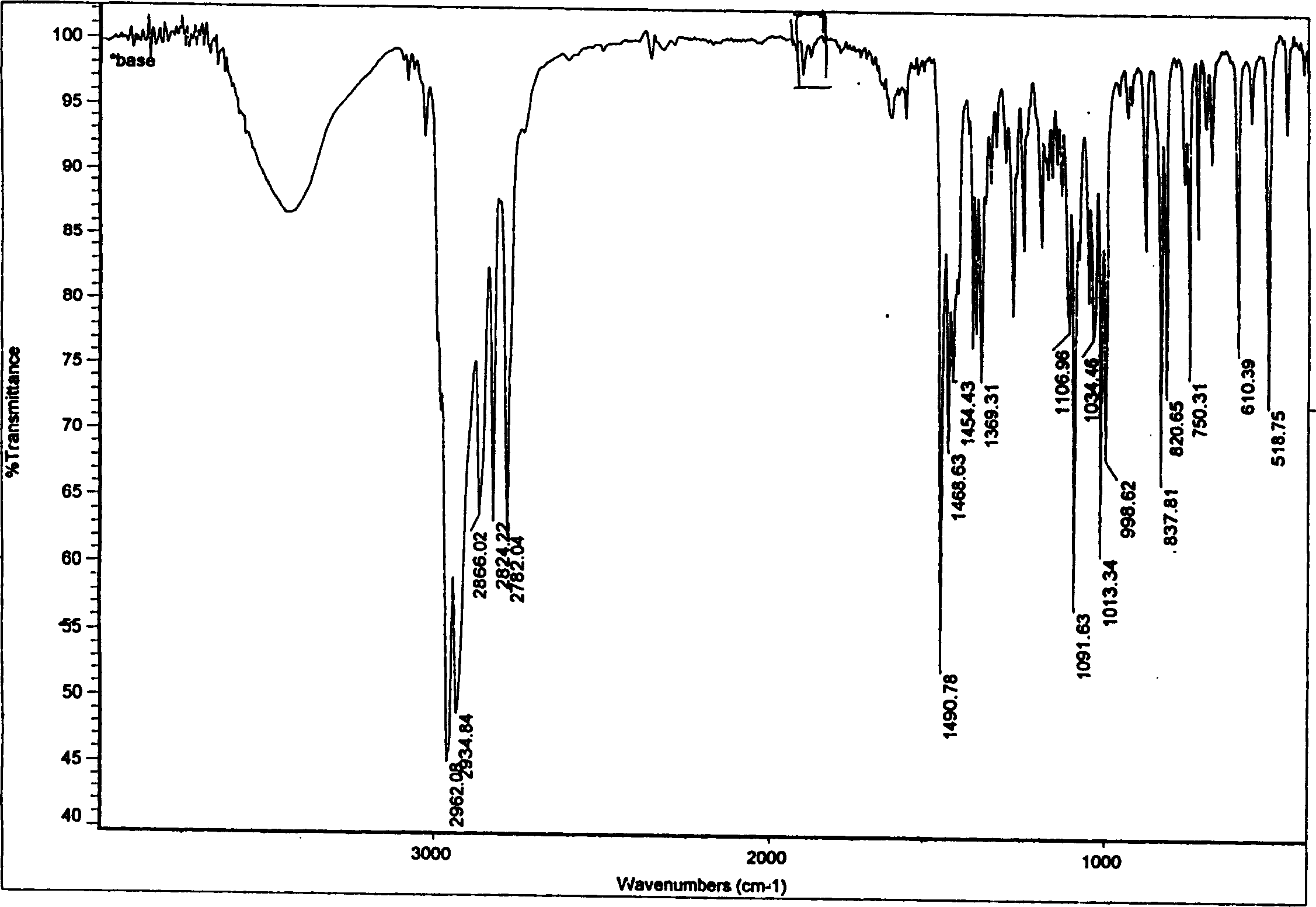 Sibutramine aromatic salt of organic acid and its preparation process