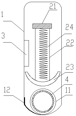 Embedded type intelligent controllable blood vessel locking device