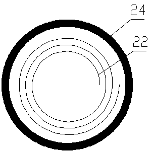 Embedded type intelligent controllable blood vessel locking device