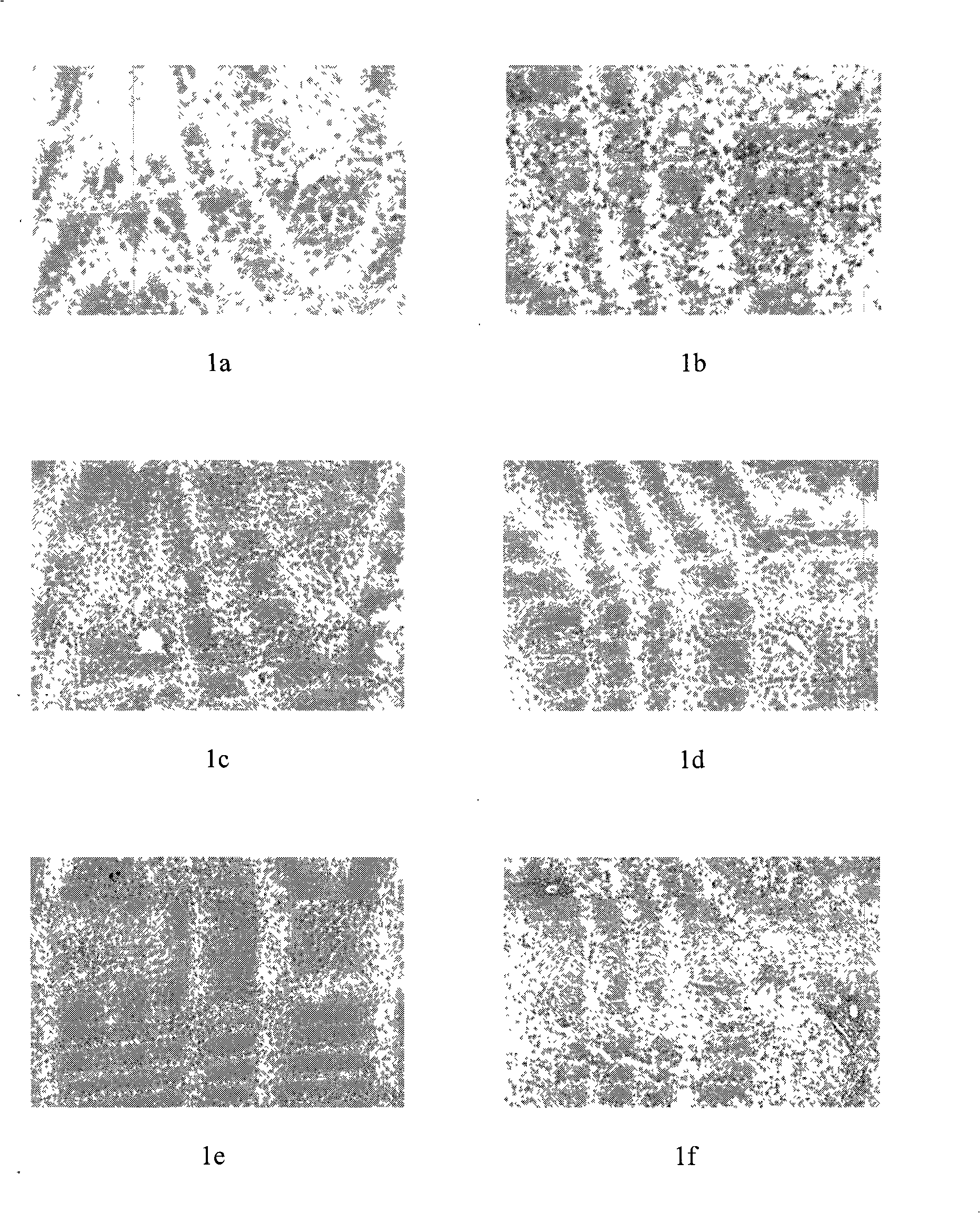 Chinese medicine with functions for reducing fat and clearing liver and preparation method thereof