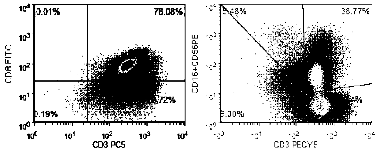 Normal-temperature cell preserving fluid and cell preparation for injection