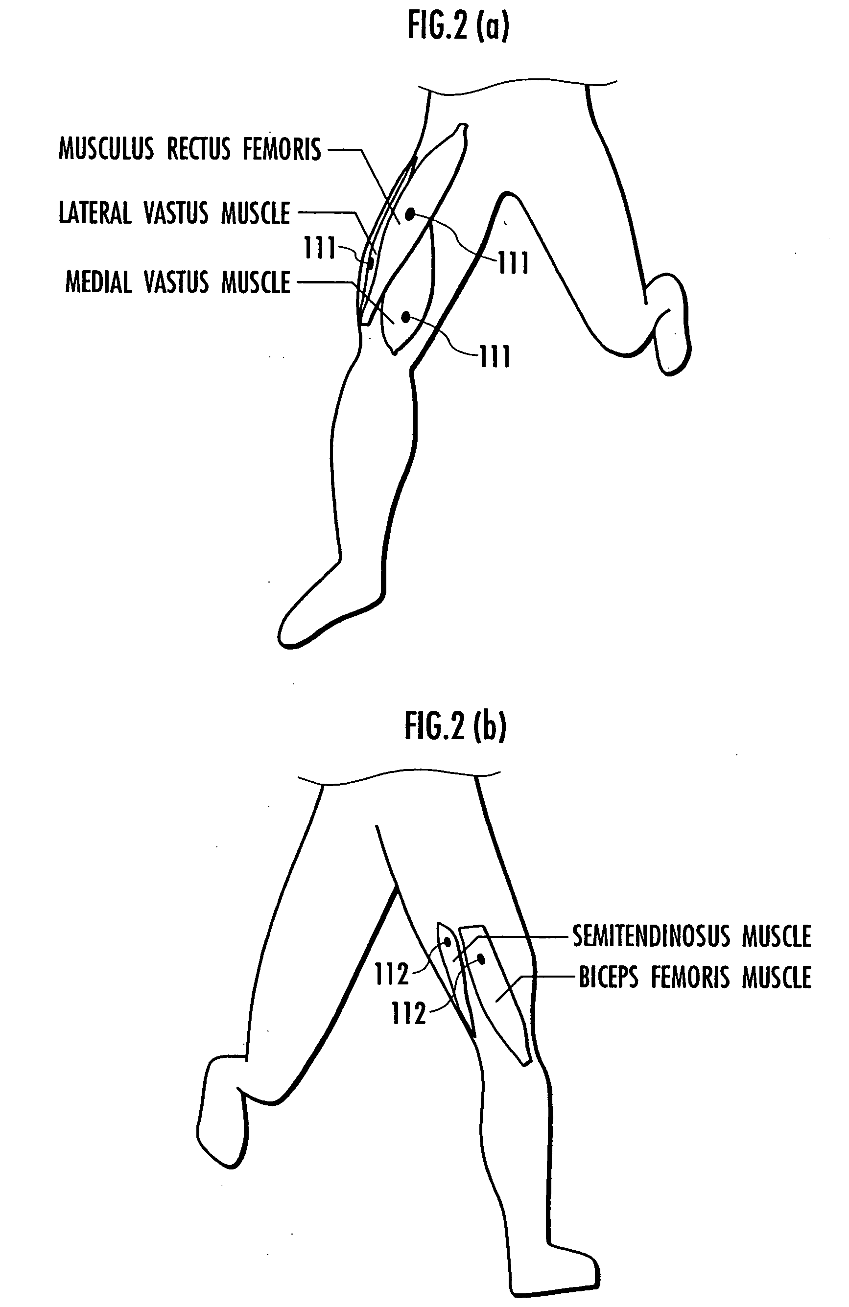 Motion measurement method, motion measurement system, and motion measurement program