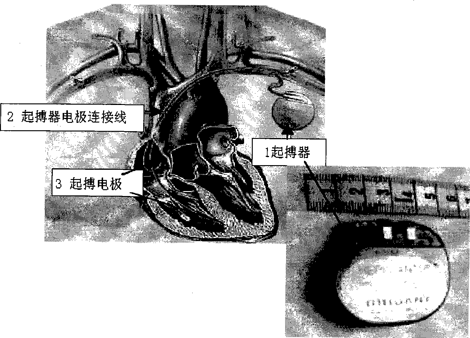 No-electrode ultrathin minitype multifunctional heart rhythm regulation and control device