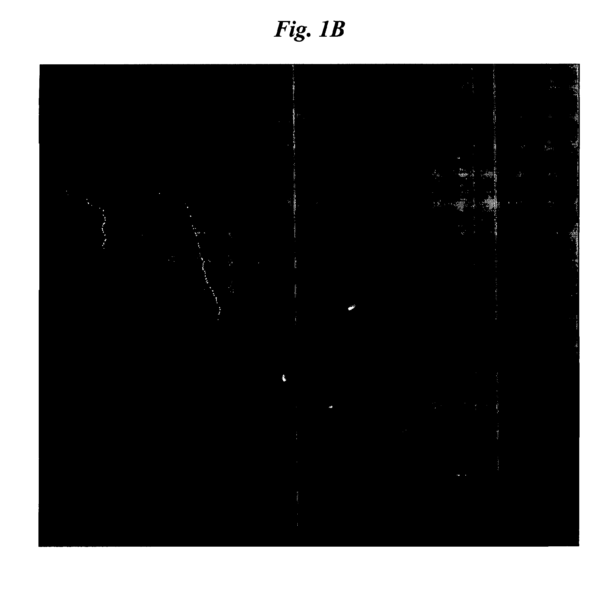 Mucoadhesive nanoparticles for cancer treatment