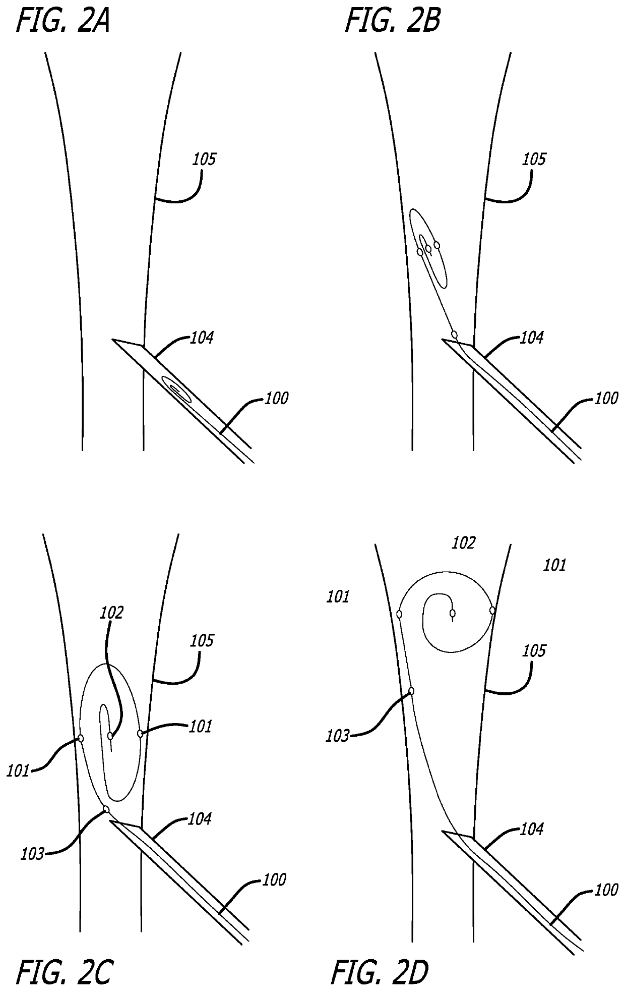 Devices And Methods For Guide Wire Placement