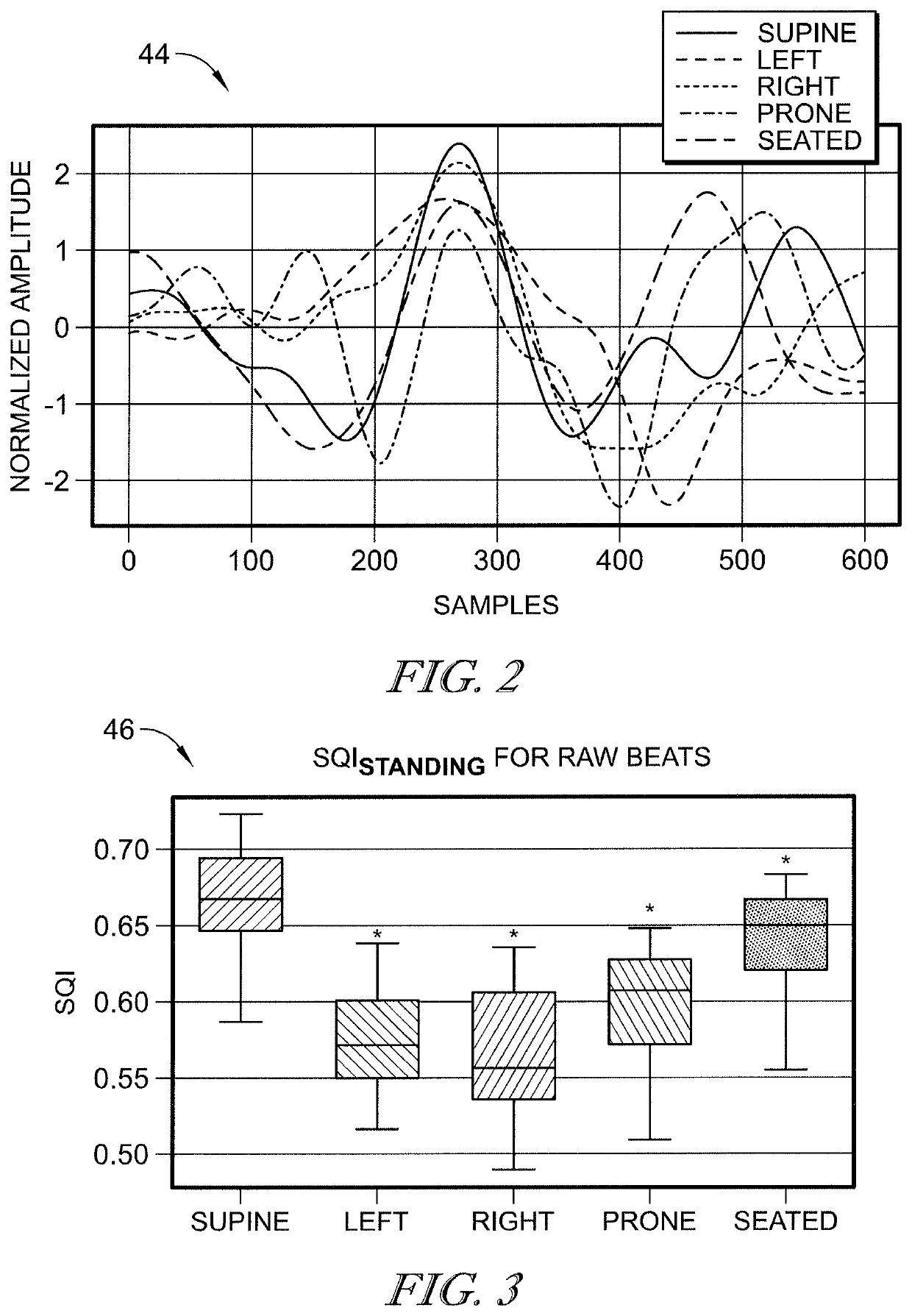 Bed-based ballistocardiogram apparatus and method