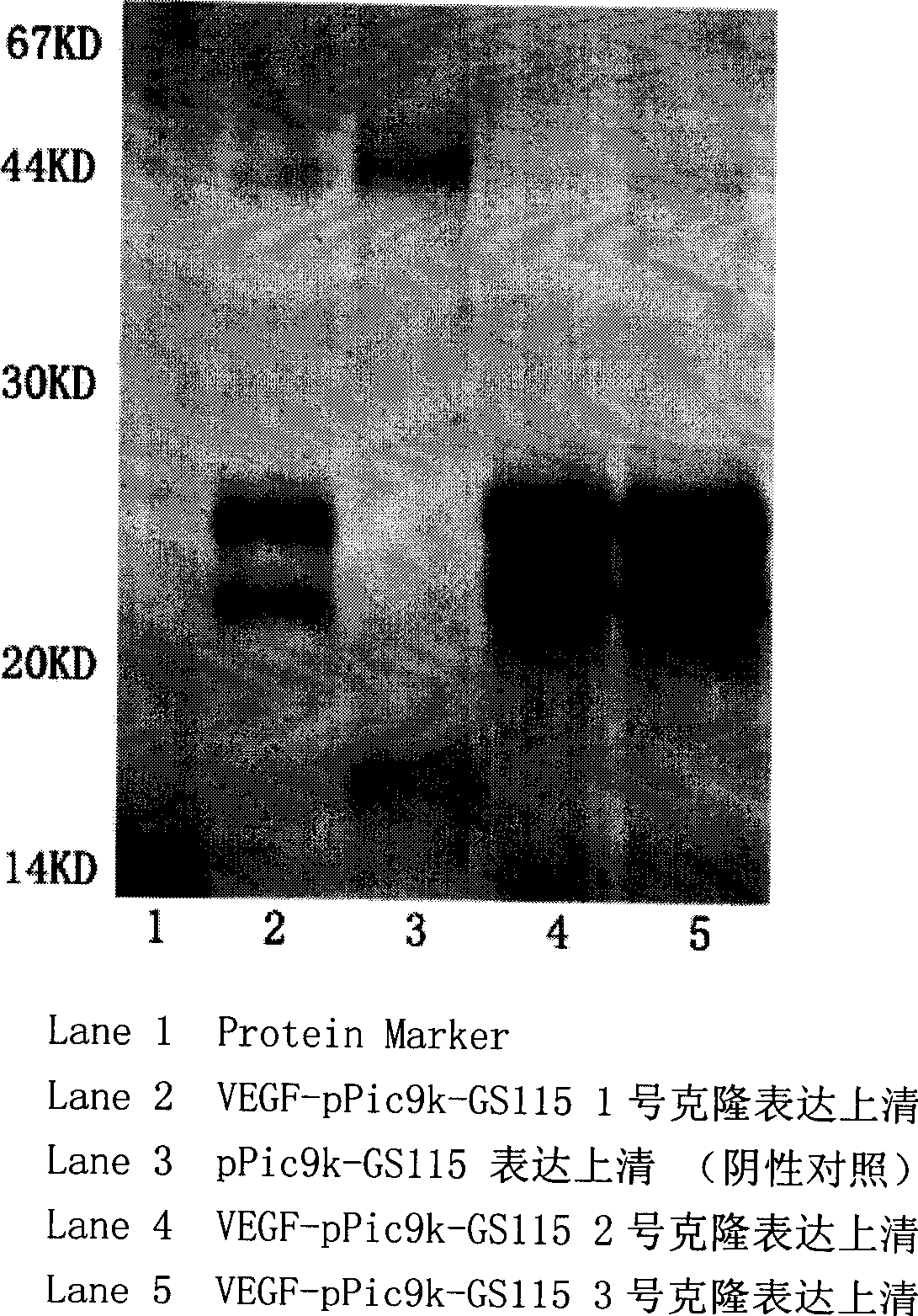 Separation and purification of recombinant human blood vessel endothelia cell growth factor, chemical labeling in vitro and use thereof