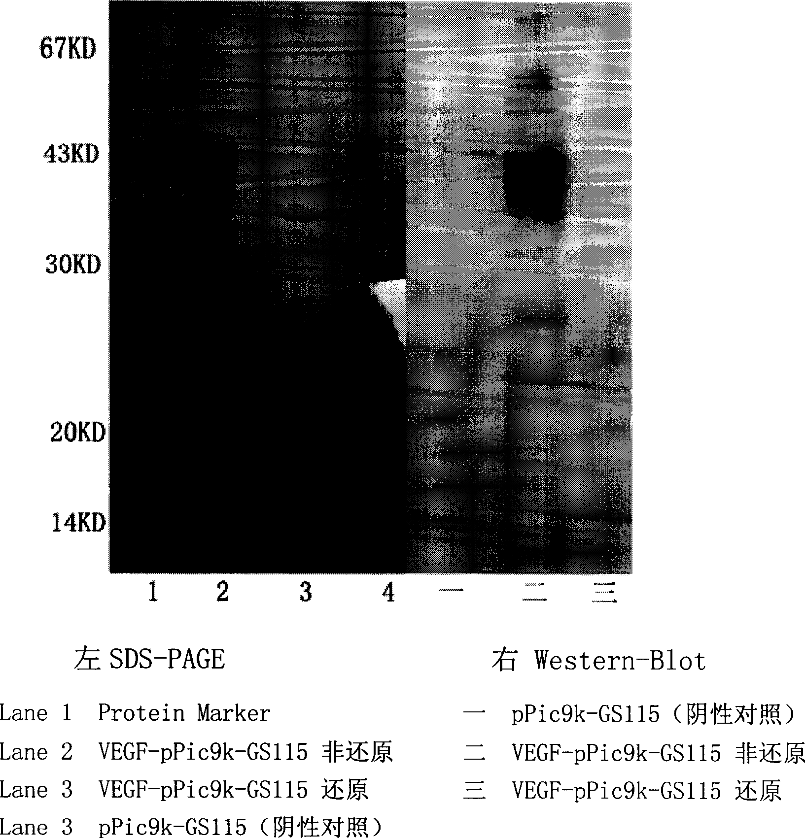 Separation and purification of recombinant human blood vessel endothelia cell growth factor, chemical labeling in vitro and use thereof