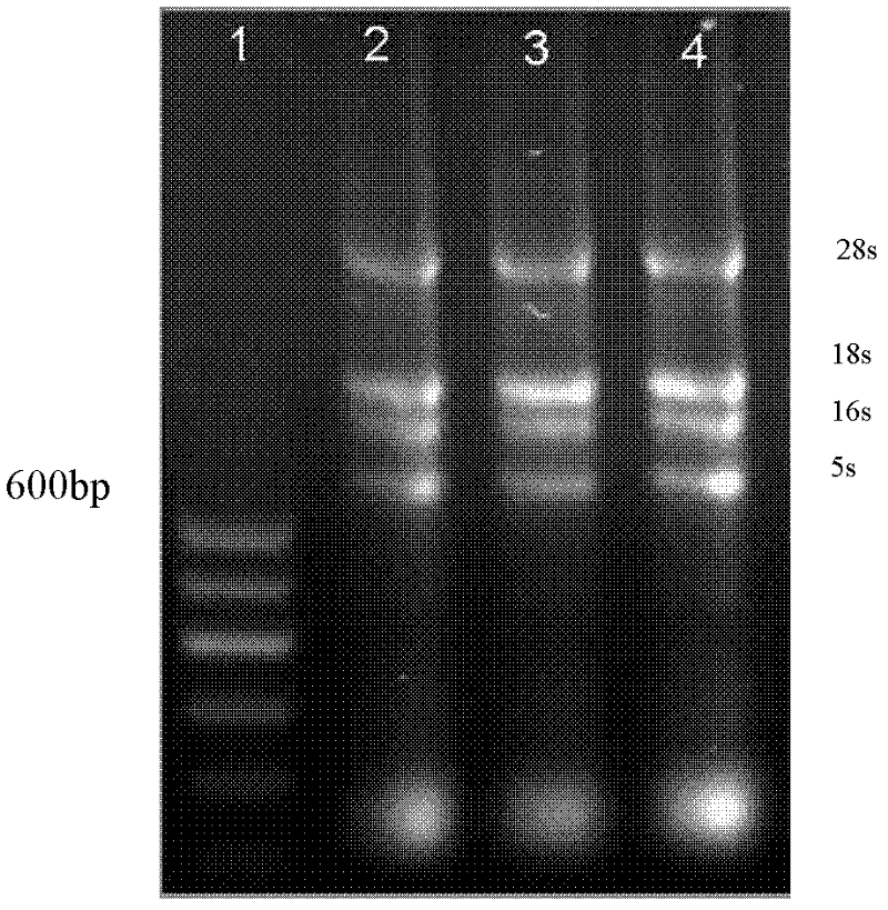 Triticum aestivum Mevalonate kinase gene TaMVK, and separation cloning and enzymatic activity determination method thereof